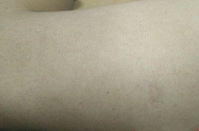 身体一处发黑暗示了2种癌症,身体有部位发黄怎回事