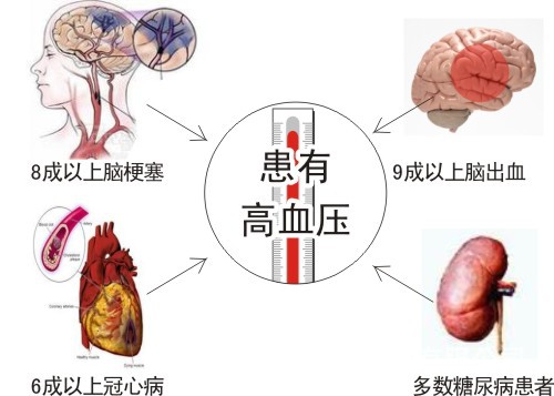 基因技术实现高血压的根本性认知和精准预防