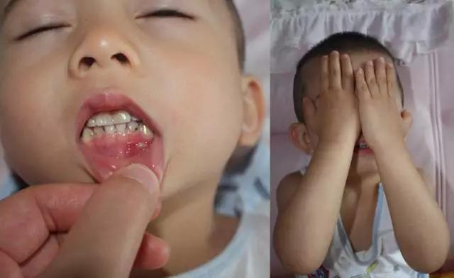 辟谣昆明部分医院停诊,昆明官方辟谣不实纪要