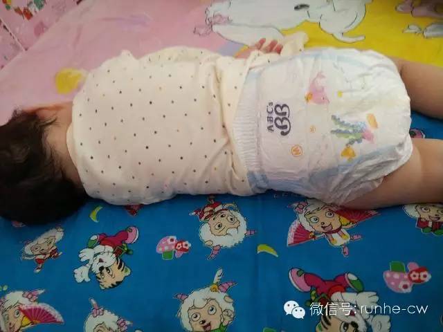 怎么快速有效的治宝宝红屁屁,宝宝突然红屁屁很严重手脚起红疹