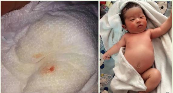 新生儿刚出生的检查结果,新生儿出生第二天体检爸爸吓坏