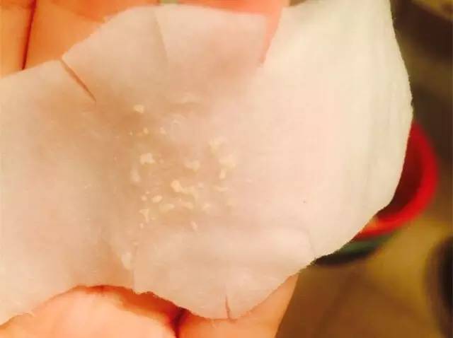 黑头难去怎么办,黑头怎么才能永远消失