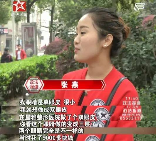 宁乡女子整容割成“三眼皮”，出门只能带墨镜！