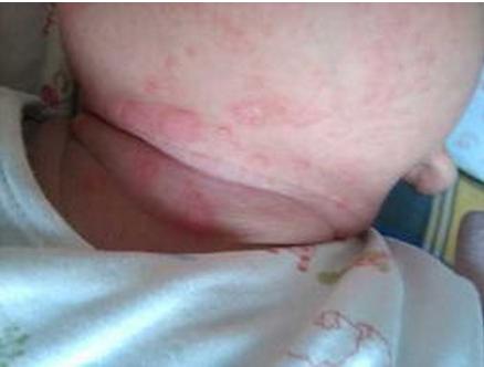 婴儿爽身粉哪个会致癌,婴儿爽身粉曝光