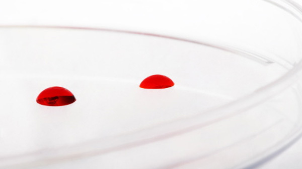 新生女婴正常生理现象,女童有发育特征多久来例假