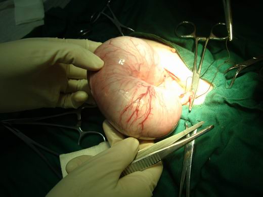 准妈妈一般会出现什么症状,准妈妈流产的话会出现哪些前兆