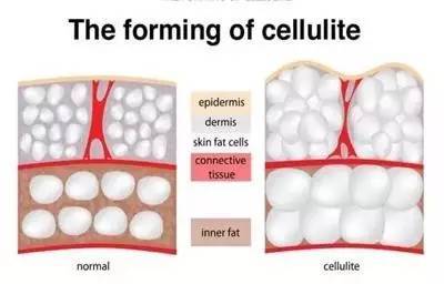紧致大腿内侧的瑜伽,瑜伽大腿内侧训练方法