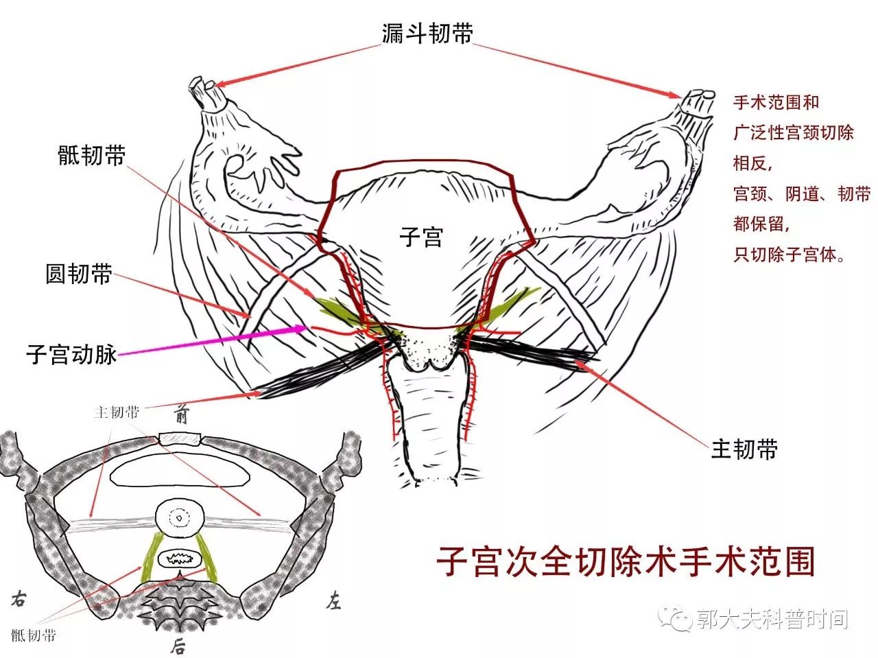 关于子宫切除的小秘密（一）——切除范围