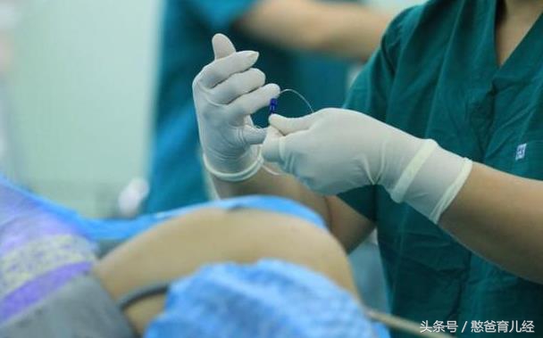 顺产的宝妈都知道要备皮，可是剖腹产也需要备皮吗？