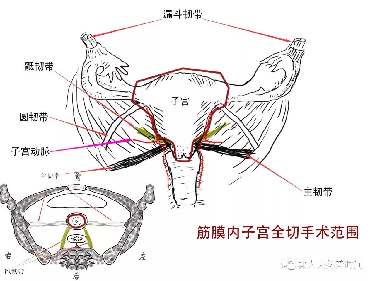关于子宫切除的小秘密（一）——切除范围