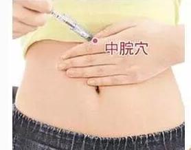 艾灸治什么病,艾灸是治疗什么病啊