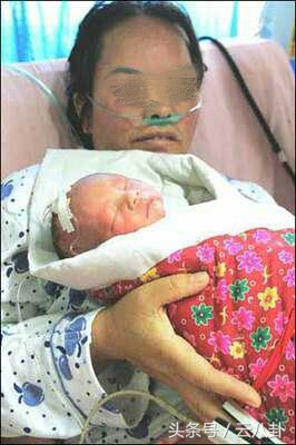 孕妇本以为小小的阴道炎没事竟是胎儿的天敌,害早产宝宝成这样