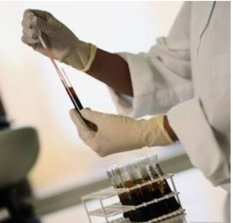 孕期耻骨疼要注意什么事项,准妈妈说说自己刚怀孕的症状