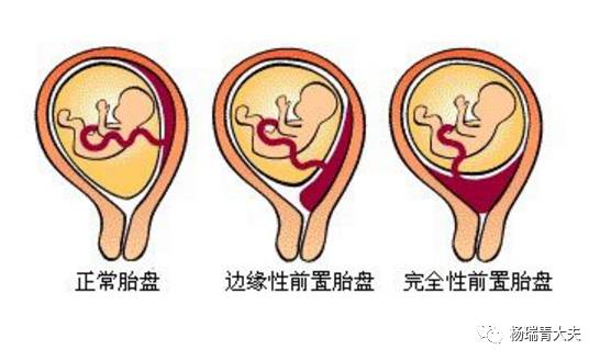 产妇生下宝宝后却没能抢救过来,产妇生了孩子平躺着腿抬不起来