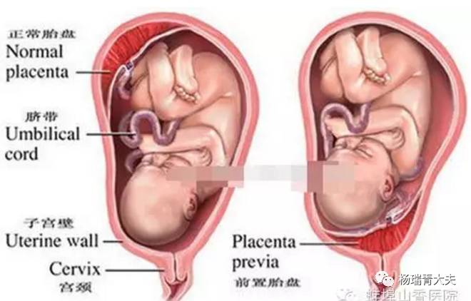 产妇生下宝宝后却没能抢救过来,产妇生了孩子平躺着腿抬不起来