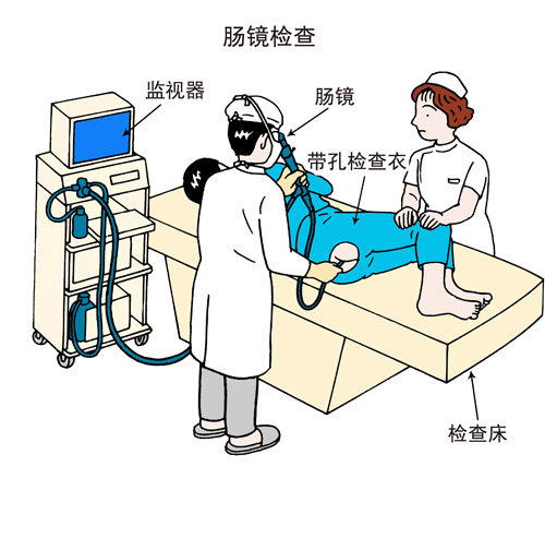 肠道迂曲,肠子是弯曲的肠镜怎么做的