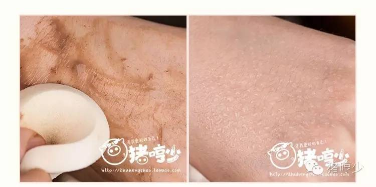 黑头难去怎么办,黑头怎么才能永远消失