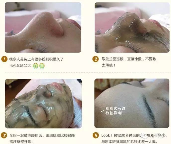 黑头难去怎么办,黑头怎么才能永远消失