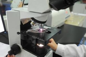 hpv筛查宫颈液基细胞学检查,宫颈hpv检查结果怎么看