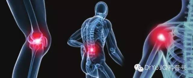 早期骨关节炎是可以治愈吗,健康科普骨关节炎注意事项