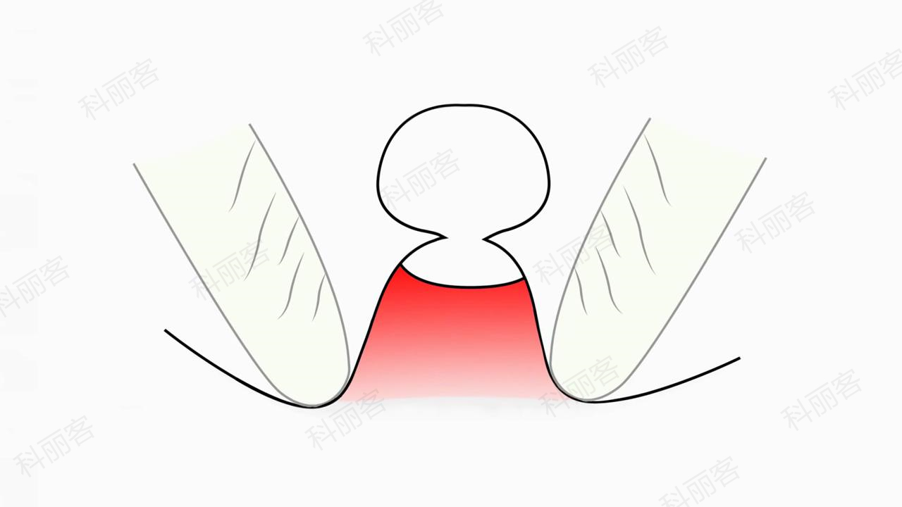 痘痘到底能不能治愈,痘痘到底能不能挤