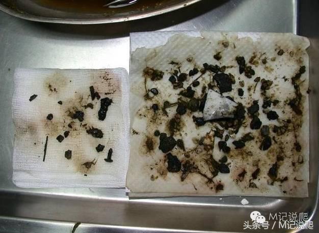 苏卡达陆龟乌龟卡脖子,苏卡达陆龟下颚裂开