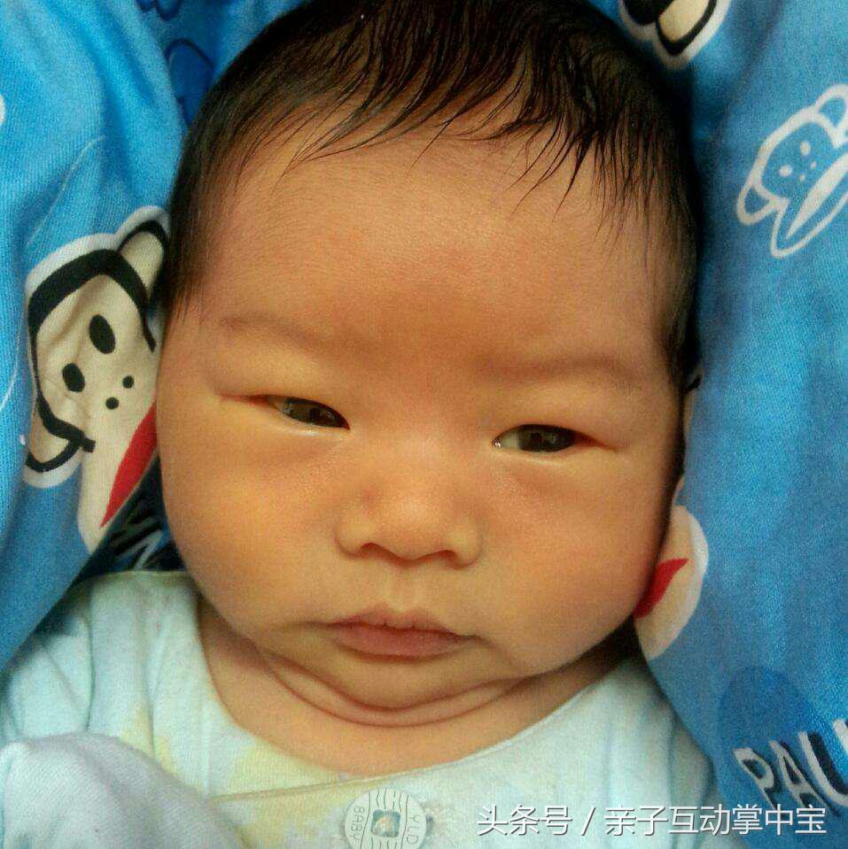 满月宝宝黄疸还没退怎么晒太阳,满月宝宝黄疸一直不退怎么办