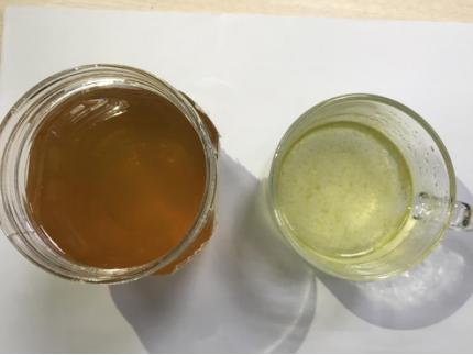 痔疮便秘最快通便的方法,便秘久了得痔疮