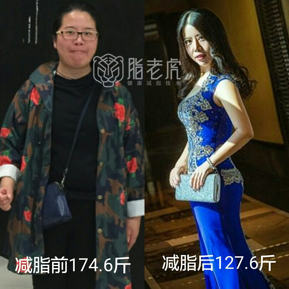 脂老虎减脂对比图片,脂老虎减肥怎么吃