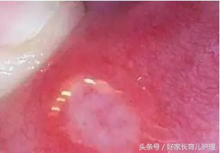 宝宝忽然不爱喝奶了,宝宝突然不爱喝奶了要吃药吗