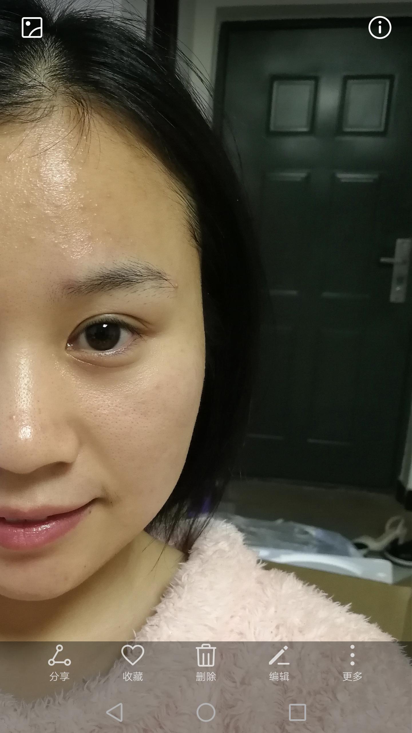 油痘敏肌肤怎么控油修复,油痘敏修护全过程