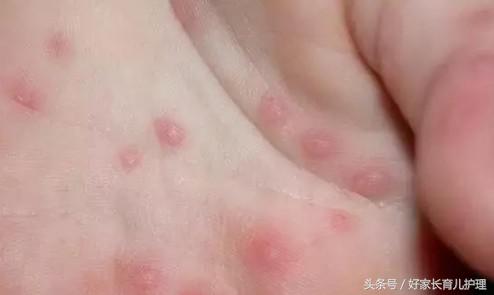 宝宝忽然不爱喝奶了,宝宝突然不爱喝奶了要吃药吗