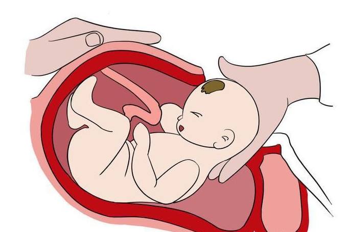 剖腹产不再可怕,有些人说剖腹产不疼是不是真的