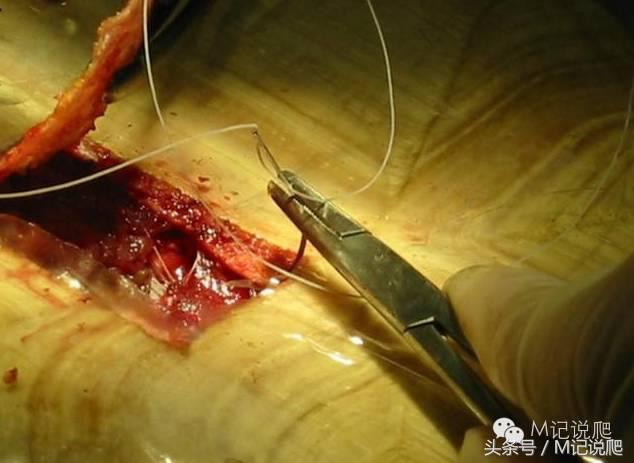 苏卡达陆龟乌龟卡脖子,苏卡达陆龟下颚裂开