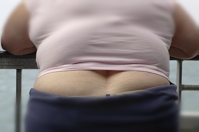 肥胖是多种病的根源,肥胖是种病减肥要趁早