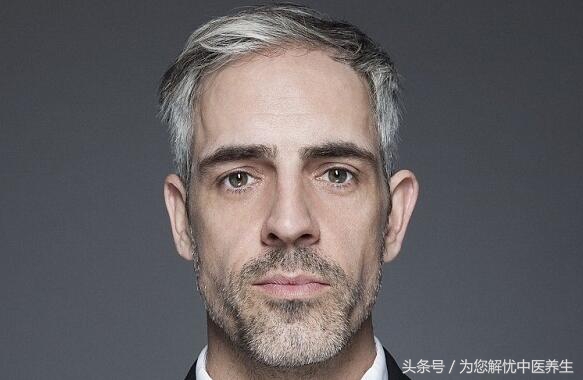 治疗严重少白头的药膳,少白头的秘方大全