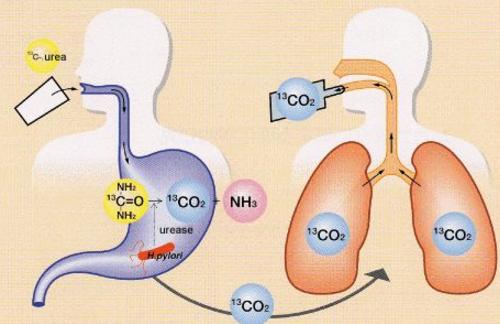 胃酸口臭口苦,胃酸口臭特别严重