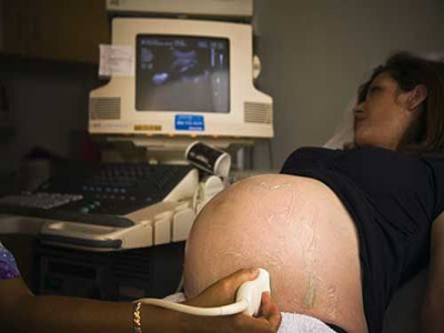 羊水最深4.5厘米是羊水少吗,怀孕羊水少了吃什么可以补羊水