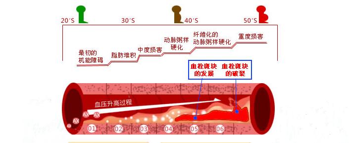 血管老化快寿命就短吗,血管特别细寿命就会短吗