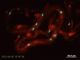 直男癌,直男癌还有救吗
