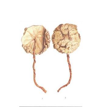 生完小孩胎盘去哪了,生孩子后的胎盘都去哪里了