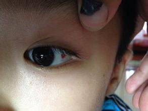 眼白出现这几种颜色，你该警惕了