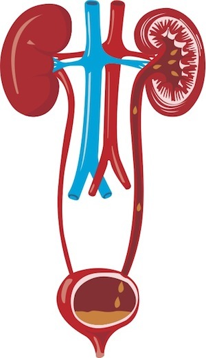 500ml水最快多久有尿,喝下去的水是怎么变成尿的