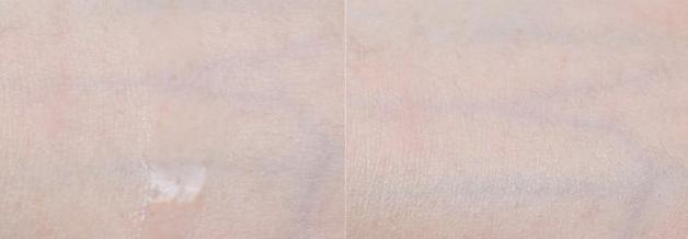 干敏皮护肤攻略,敏皮可敷面膜吗