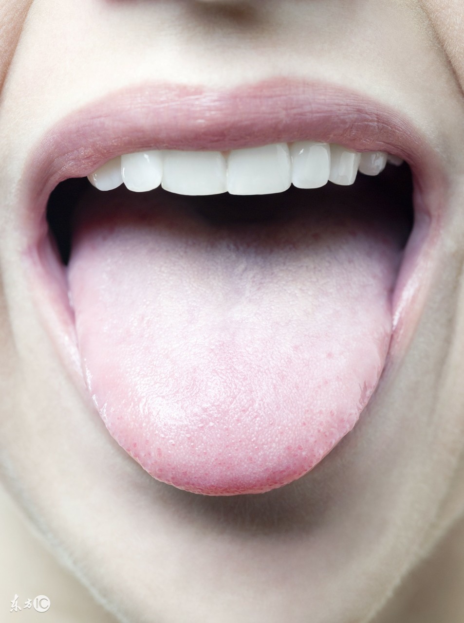 舌苔是厚厚的白苔用“姜”治口臭;舌苔发黄喝“萝卜汁”治口臭