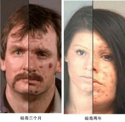 “僵尸浴盐”，吸食后宛如丧尸，上演现实版行尸走肉