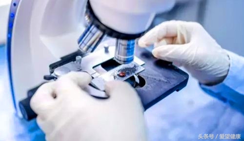 年轻人混合型高血脂吃什么药,年轻人高血脂是什么原因引起的