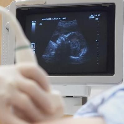 看不懂产检b超视频,看不懂医院测孕检查单怎么办