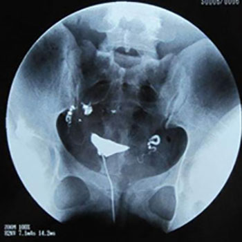 面对不孕不育，该如何正确的看诊治疗？