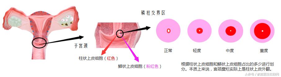 这几种妇科病不用花钱治,这4种妇科病不要盲目治疗